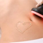 Ultrasonic Fat Cavitation: Top Products to Use and Pitfalls to Avoid