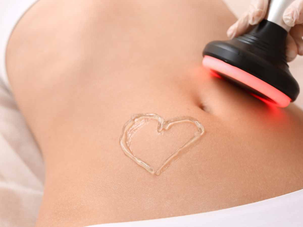 Ultrasonic Fat Cavitation: Top Products to Use and Pitfalls to Avoid