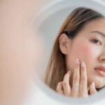 Understanding Rosacea: Comprehensive Guide to Treatment and Skincare