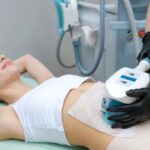 Freeze Away Your Fat: Understanding the Cryolipolysis Process