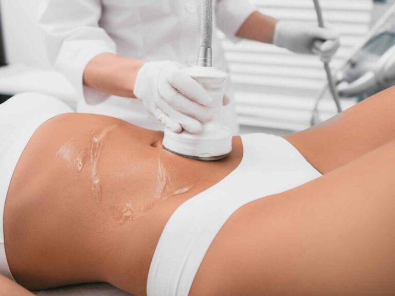 Realistic Expectations: What Non-Invasive Body Sculpting Can and Cannot Do