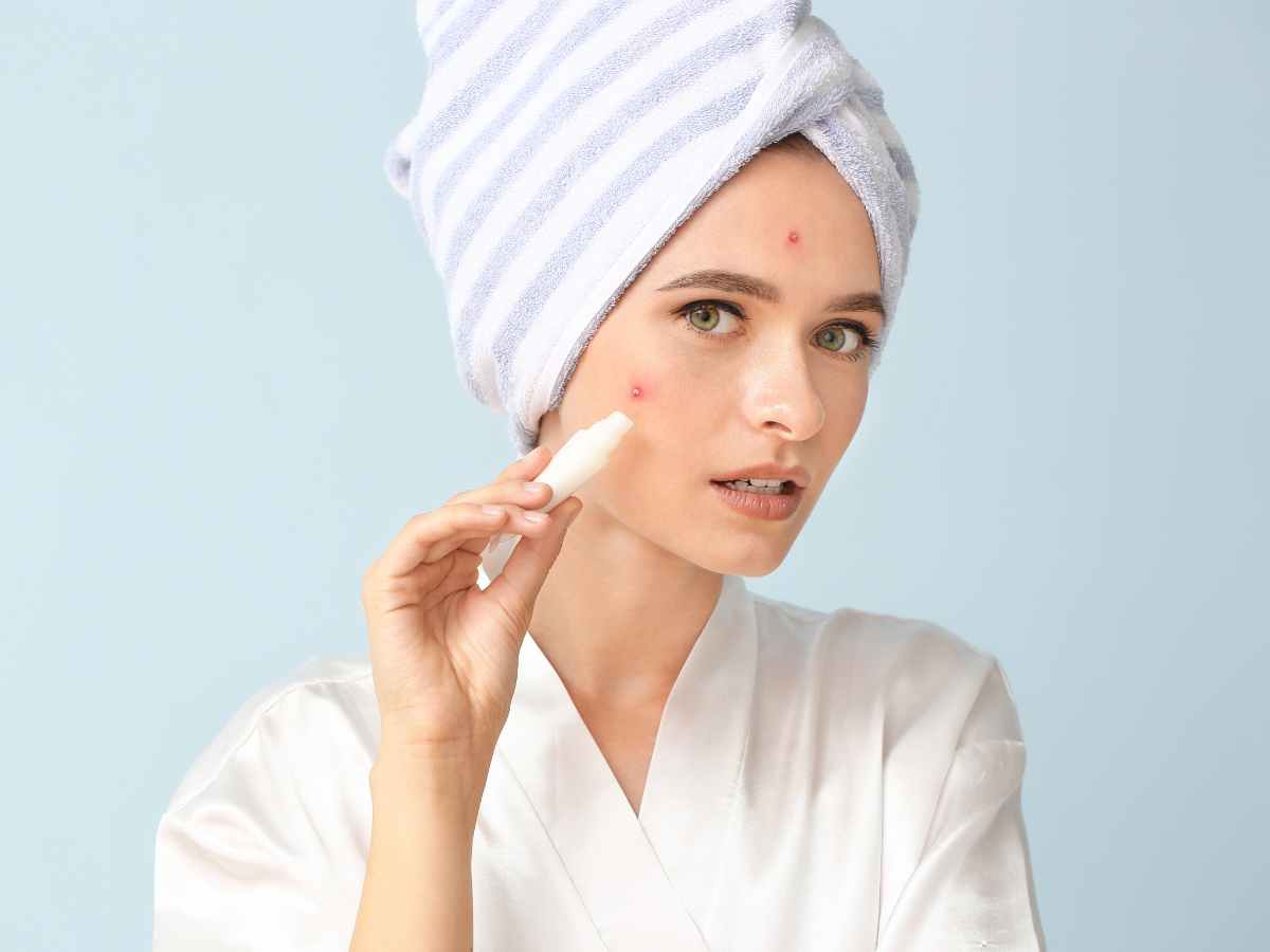 The 4 types of Acne: Treatment Methods, Essential Products, and Things to Avoid
