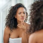 Why Do I Keep Breaking Out? 10 Culprits of Acne and Their Remedies