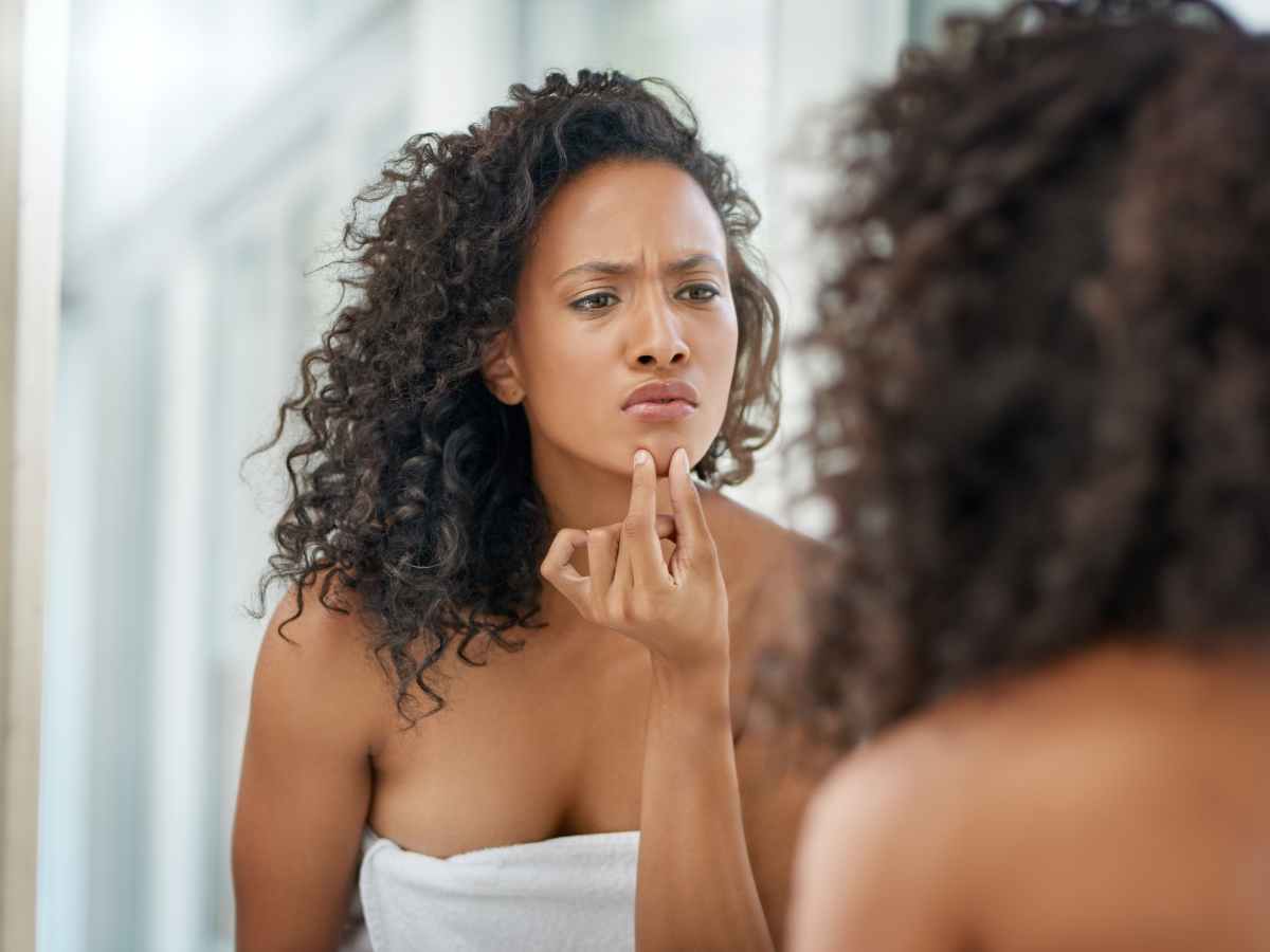 Why Do I Keep Breaking Out? 10 Culprits of Acne and Their Remedies